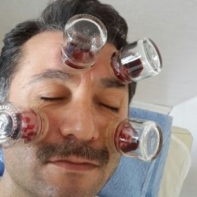Sinüzit Şikayetleri