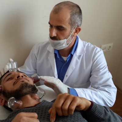Yüz Felci İçin Hacamat Uygulaması