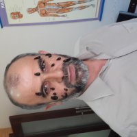 Sülük Cilt Güzelliği İçin